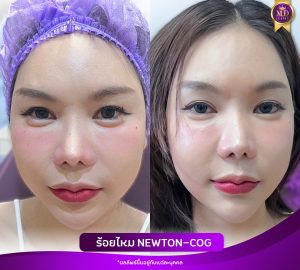 รีวิวร้อยไหม newton-cog