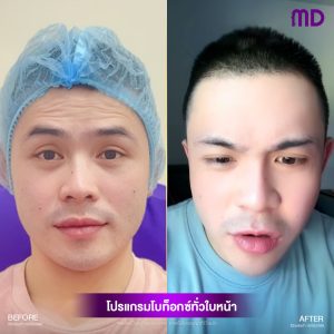 โบริ้วรอย (คุณทินกร)