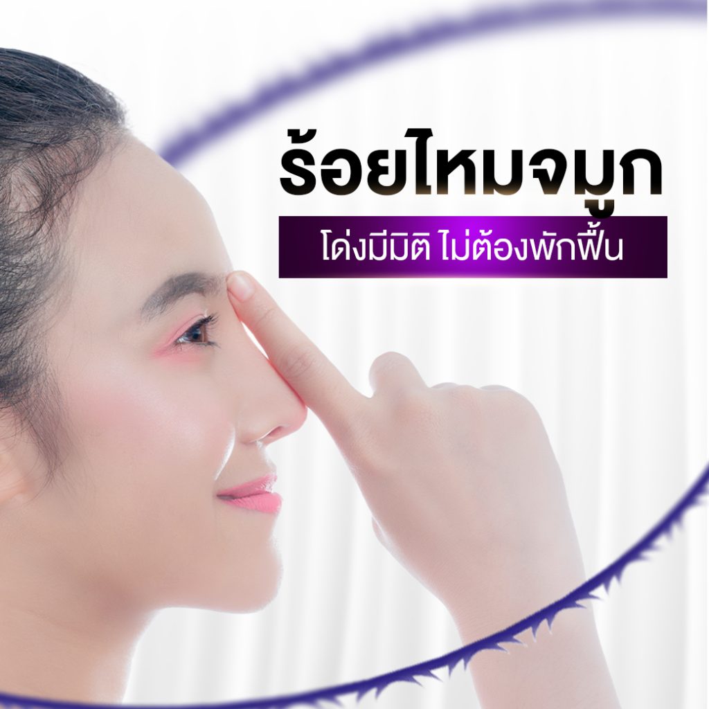 ไหมจมูกปก