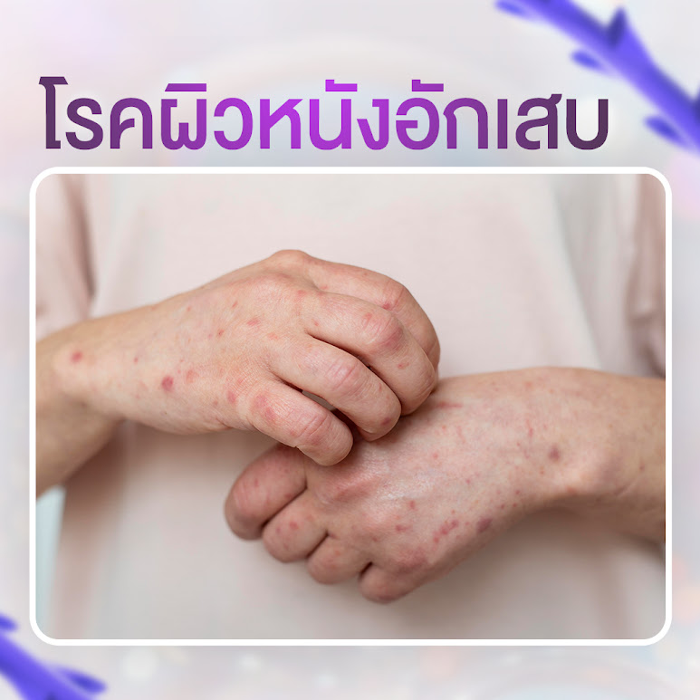 5 โรคประจำตัวที่ห้ามร้อยไหม