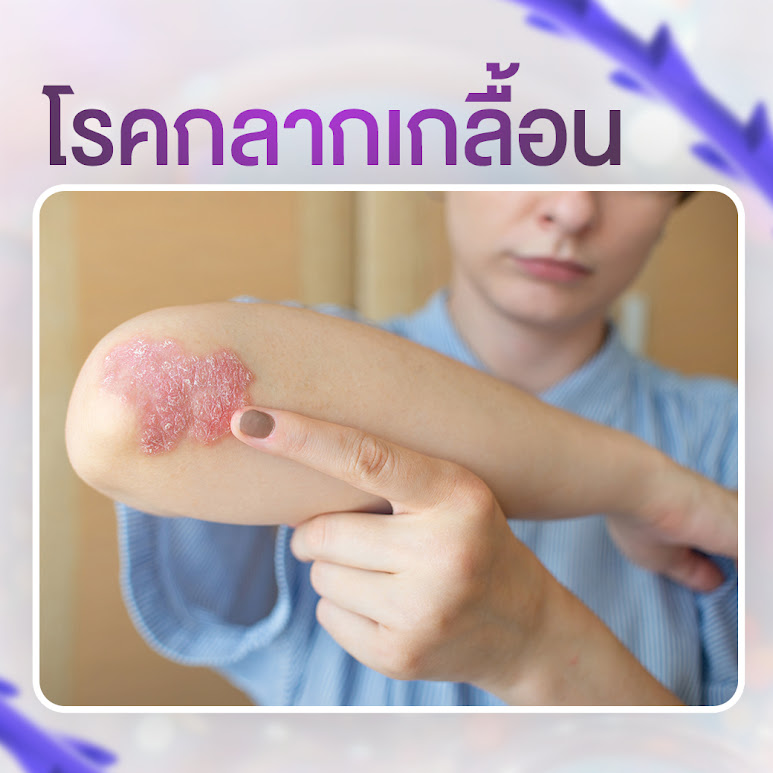 5 โรคประจำตัวที่ห้ามร้อยไหม
