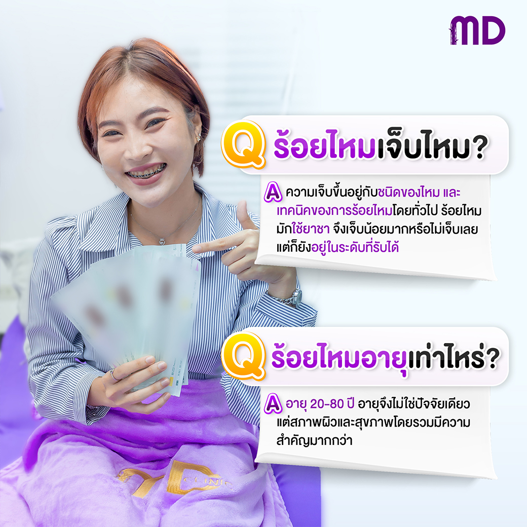 ร้อยไหมครั้งแรกเจ็บไหม