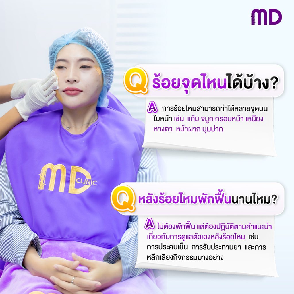 ร้อยไหมเจ็บไหม