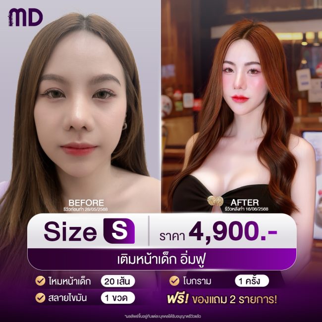 โปรเอ็มดีคลินิก