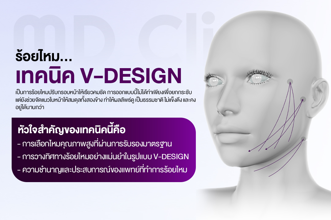 ร้อยไหมหน้า v-Design.