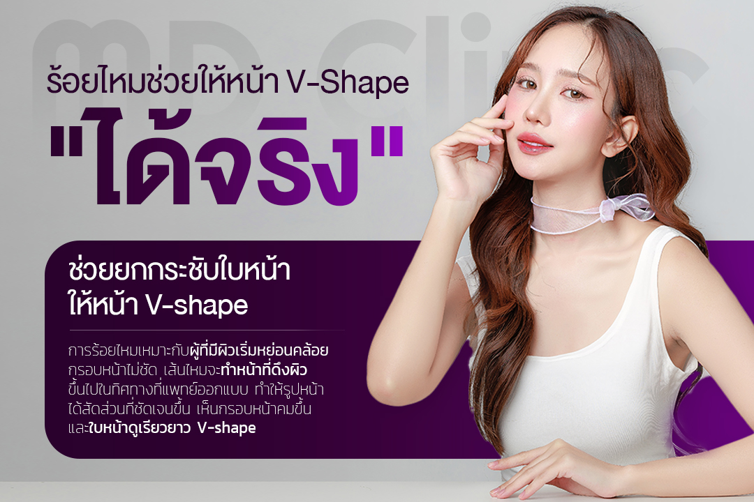 ร้อยไหมหน้า v-shape ได้จริง