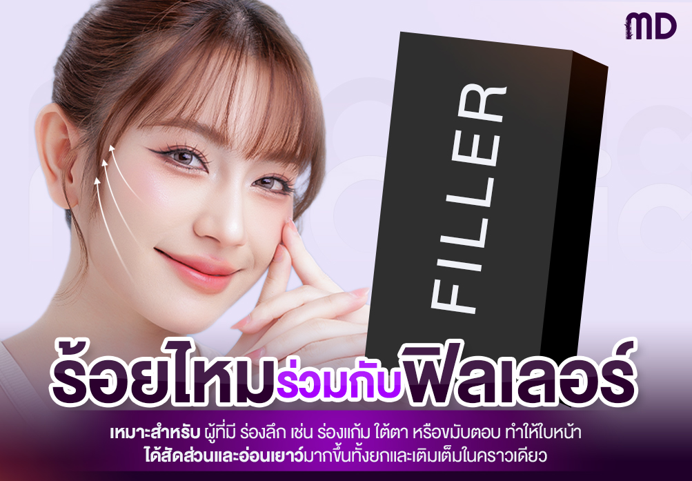 ร้อยไหมทำร่วมกับฟิลเลอร์.