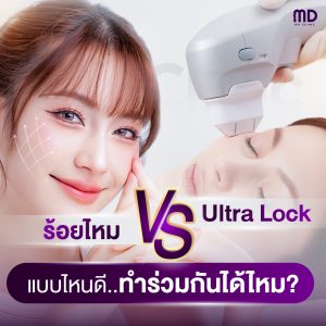 ร้อยไหม VS Ultra Lock